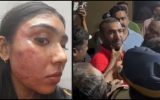 പൊട്ടിക്കരഞ്ഞ് ജൂനിയറെ ഇടിച്ച് പഞ്ചാറാക്കിയ ബെയ്‌ലിന്‍ ദാസ്; പറ്റിപ്പോയെന്ന് പരിദേവനം; ആശ്വസിപ്പിച്ച് അഭിഭാഷകര്‍