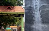 ആരോഗ്യവകുപ്പിന്റെത് ഡോക്ടറെ സംരക്ഷിക്കാനുള്ള ശ്രമങ്ങൾ; ആരോപങ്ങളുമായി പരാതിക്കാരി