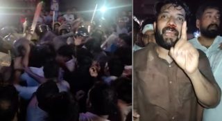 ഷാഫി പറമ്പിലിനെ പോലീസ് തല്ലിയത് തന്നെ; മൂക്കിന്റെ എല്ലിന് രണ്ട് പൊട്ടല്‍; സിപിഎം സോഷ്യല്‍ മീഡിയ പ്രചരണം തെറ്റ്