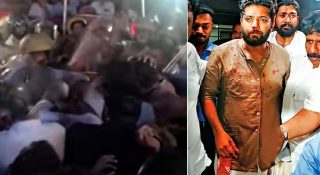 ഷാഫിയുടേത് ഇമേജ് തിരിച്ചു പിടിക്കാനുള്ള ഷോ!! മുഖത്ത് കണ്ടത് ചോരയല്ല, ചുമന്ന മഷിയെന്ന് പരിഹസിച്ച് ഇടത് സൈബർ ഹാൻഡിൽസ്