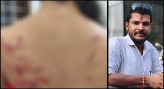 ലിവ് ഇന്‍ പങ്കാളിയെ ക്രൂരമായി മര്‍ദിച്ച് യുവമോര്‍ച്ച നേതാവ്; യുവതിയുടെ ദേഹമാസകലം പരിക്ക്; അറസ്റ്റ്